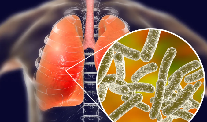 伦敦突然爆发！致命细菌引发疫情，藏在空调和水龙头里？官方紧急调查…